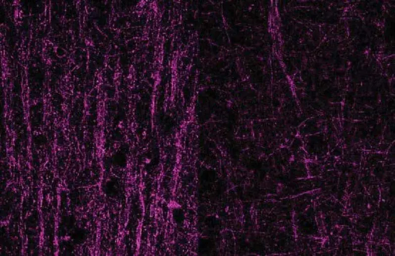 Microscopic image showing gene expression in the brain.