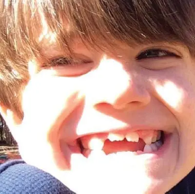 Close-up of a young child smiling, with missing front teeth.