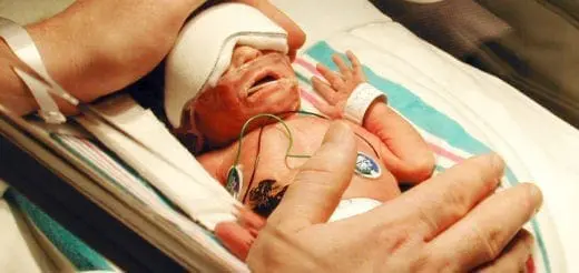 Miracle Babies what you need to know