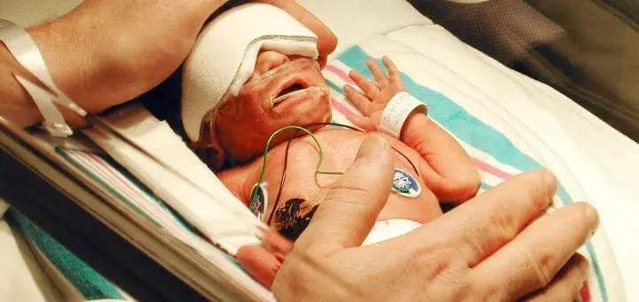 Miracle Babies what you need to know