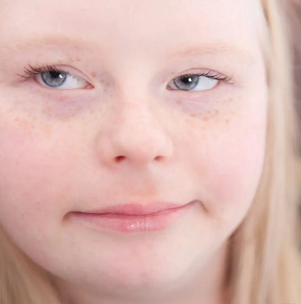 Angel with fair skin, freckles, and light blue eyes looks to the side.