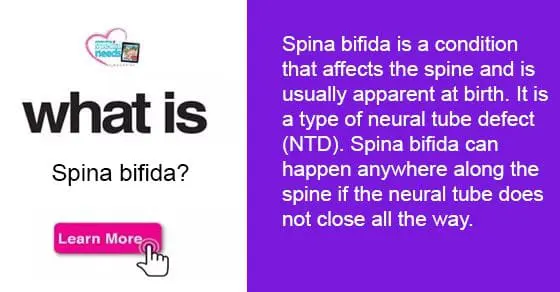 Text and illustration explaining spina bifida.