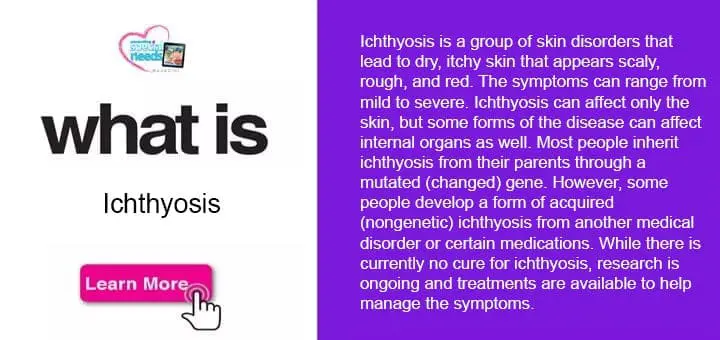What is Ichthyosis