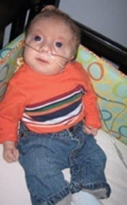 Eliot Mooney sits in his crib wearing an orange striped shirt and blue jeans while using a nasal cannula.