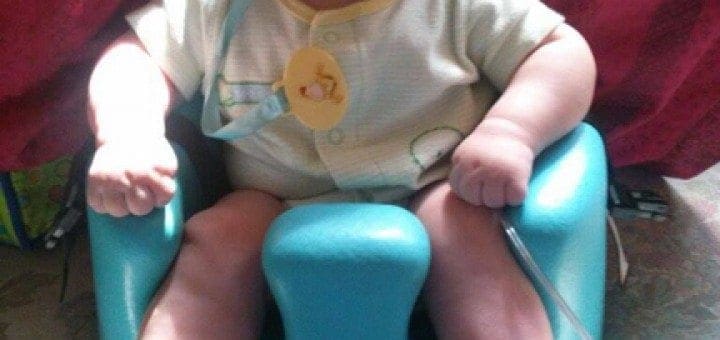 Baby Noel sits in a blue seat wearing a cranial helmet and leg braces.