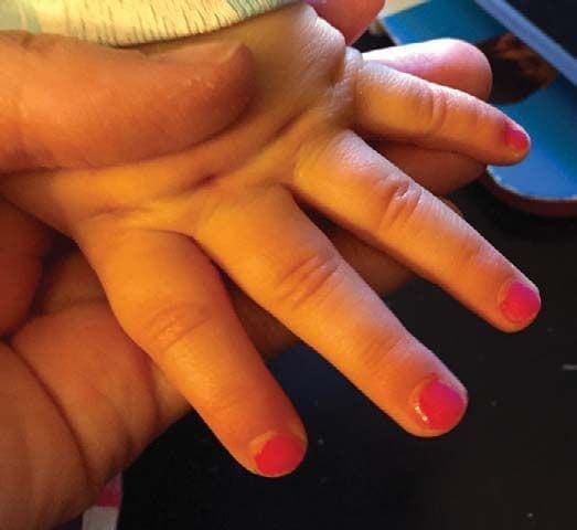 A child's hand with bright pink nail polish being held by an adult.