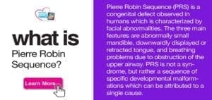 Information about Pierre Robin Sequence with a "Learn More" button.