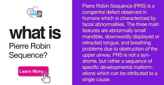 Explanation of Pierre Robin Sequence with facial abnormalities and a "Learn More" button.