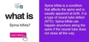 Text defining spina bifida and a button to learn more.