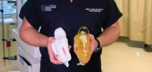 Two fetal models, one white and one translucent yellow with a skeleton, are held by a person in scrubs.