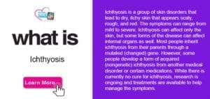 Text and graphics explaining what Ichthyosis is, with a "Learn More" button.