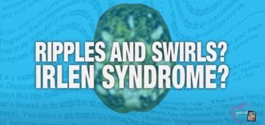 Text on a blue background with a blurry green pattern reads "RIPPLES AND SWIRLS? IRLEN SYNDROME?