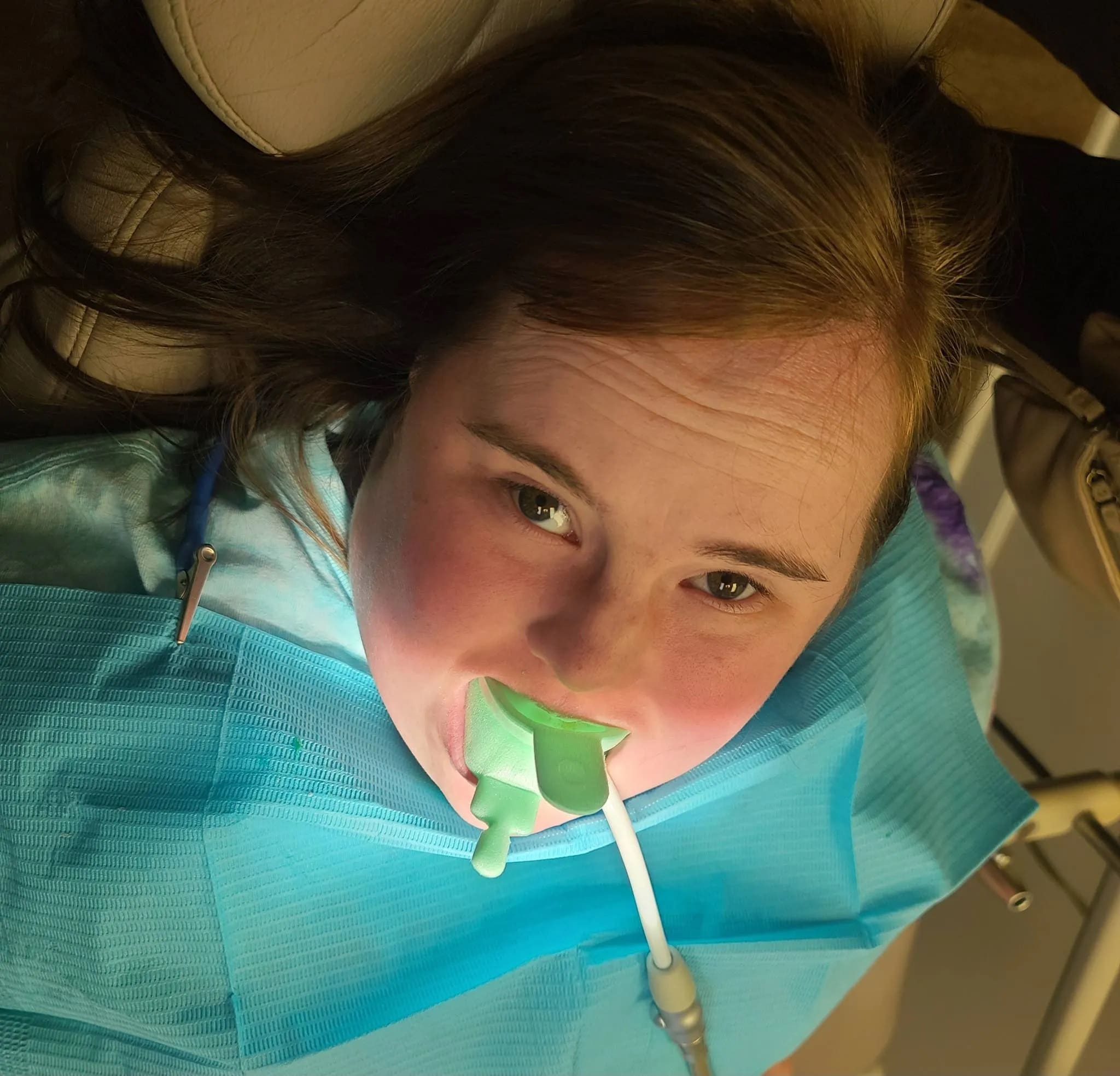 Young girl with Down syndrome at the dentist with a dental dam in her mouth.